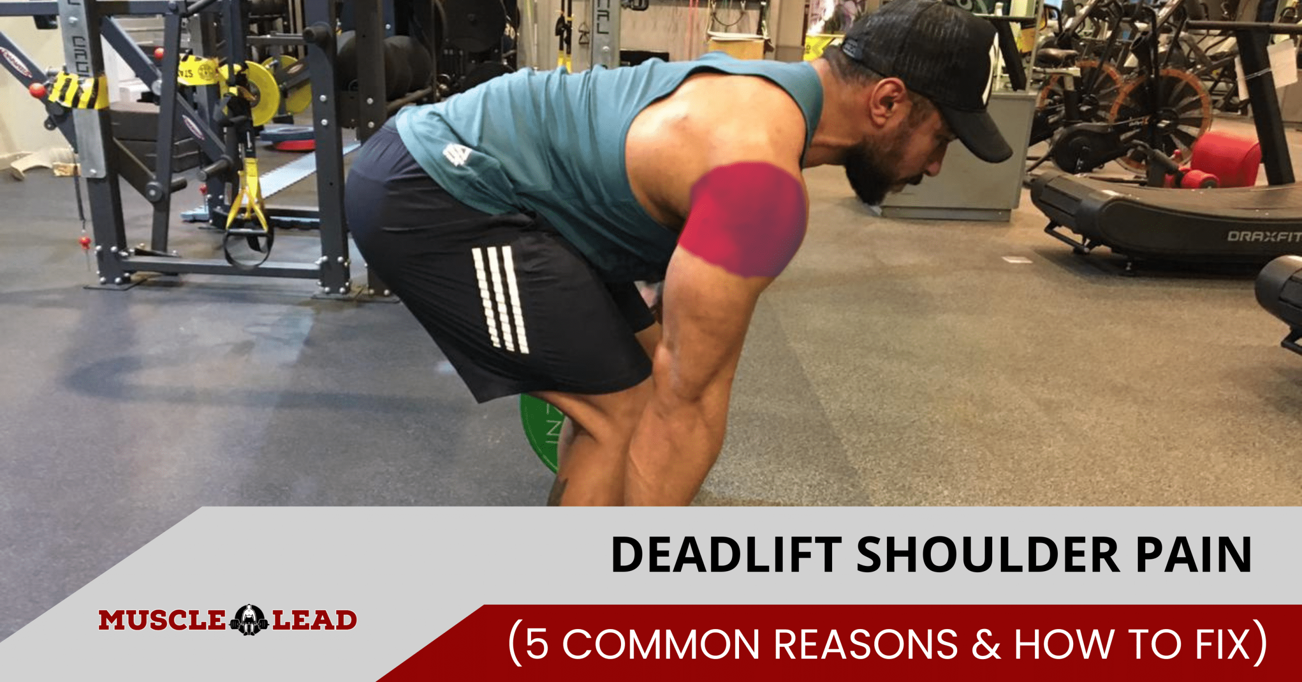 Deadlift Shoulder Pain 5 Common Reasons & How to Fix